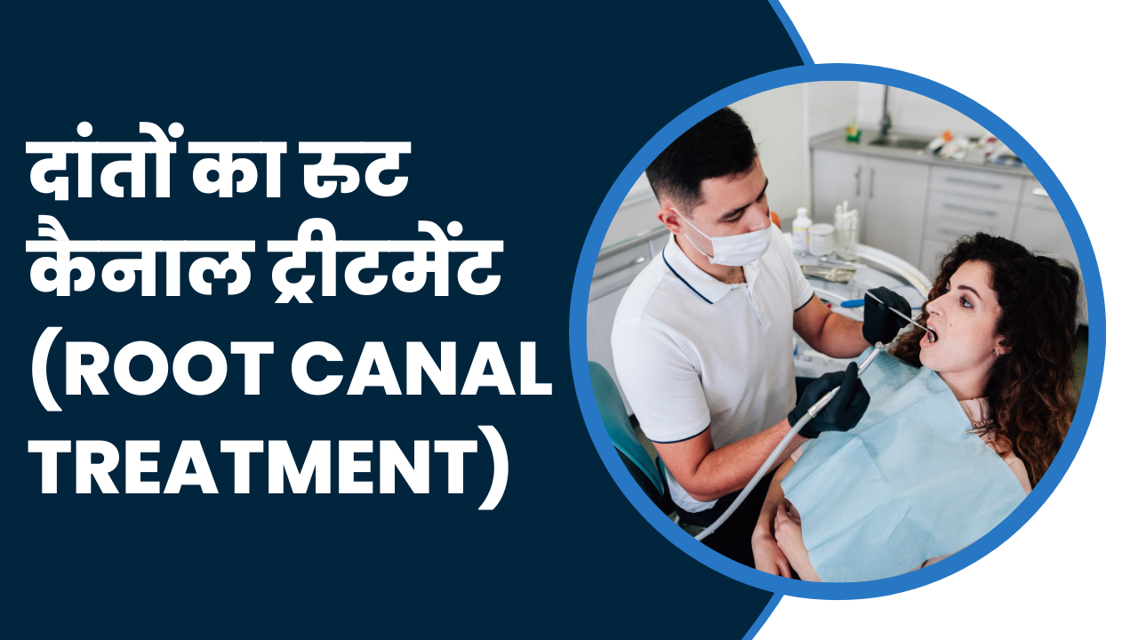 http://blog.sghshospitals.com/uploads/root_canal_treatment_dental