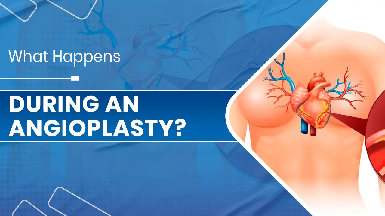 Angioplasty