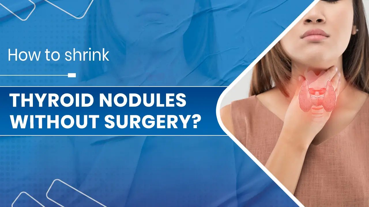 Thyroid nodules without surgery