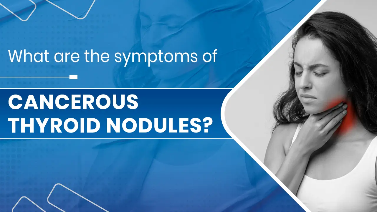 cancerous thyroid nodules