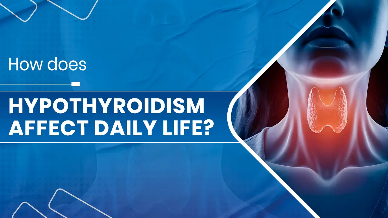 Hypothyroidism affect daily life