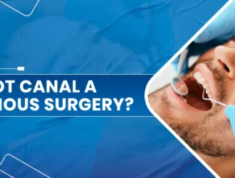 Root canal a serious surgery