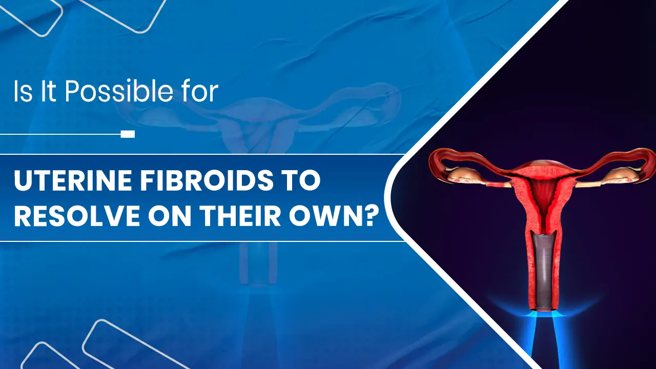 Uterine Fibroids
