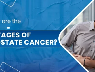 4 stages of cancer treatment