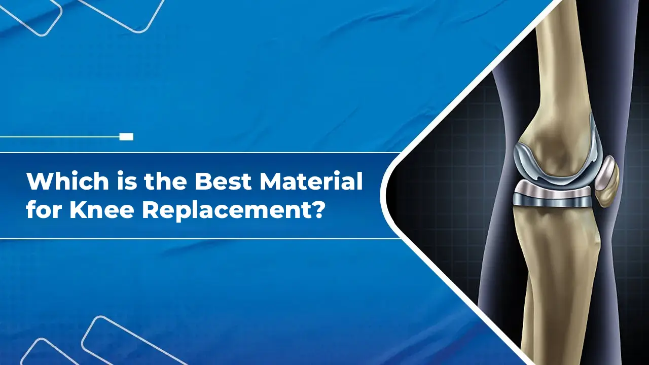 Best Material for Knee Replacement