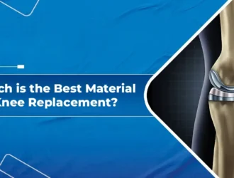 Best Material for Knee Replacement