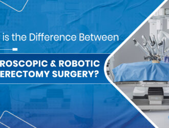 Hysterectomy Surgery