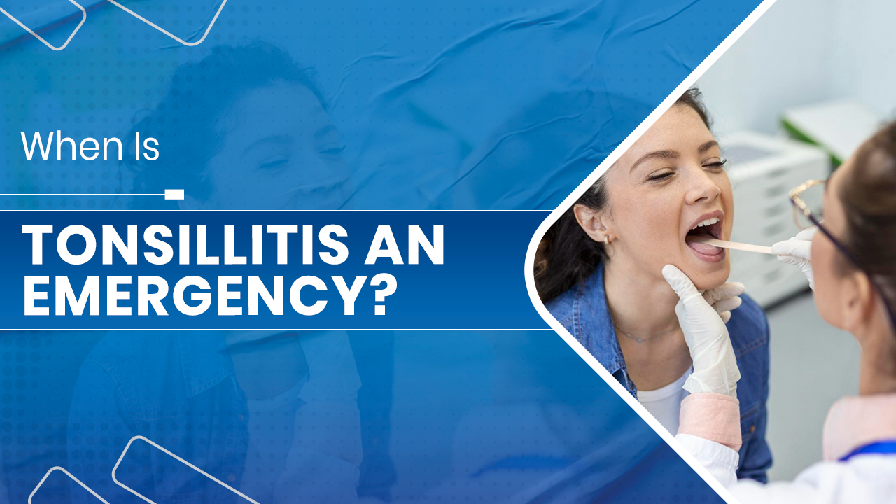 Tonsillitis treatment​