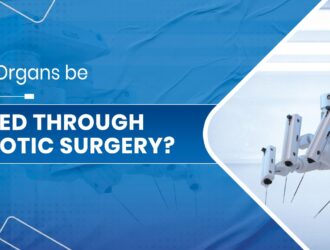 Robotic Surgery