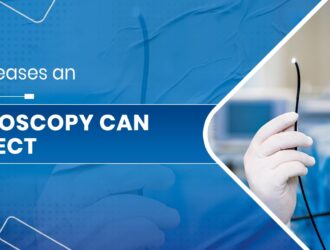 Endoscopy