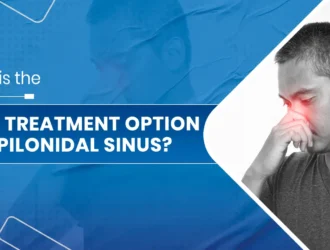 Best Treatment Option for Pilonidal Sinus