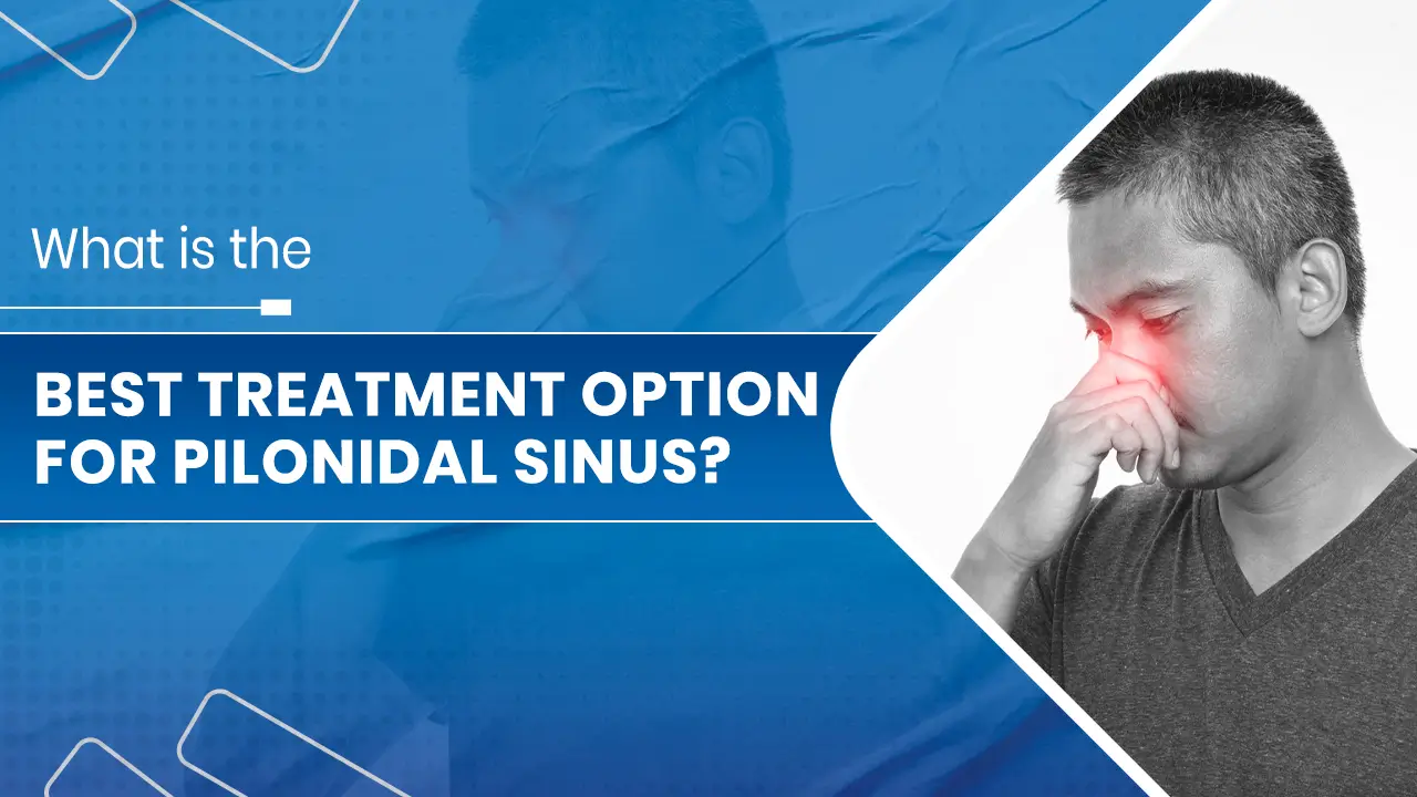 Best Treatment Option for Pilonidal Sinus