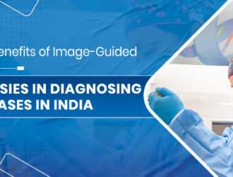 Cancer Specialist in Chandigarh