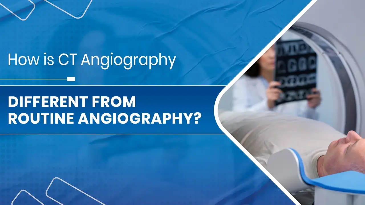CT Angiography 01