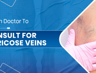 Varicose Veins