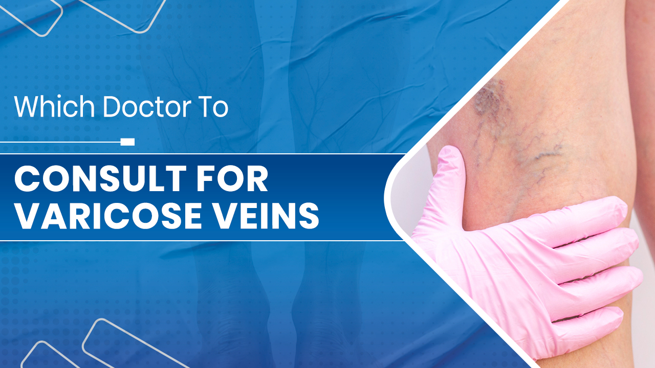 Varicose Veins
