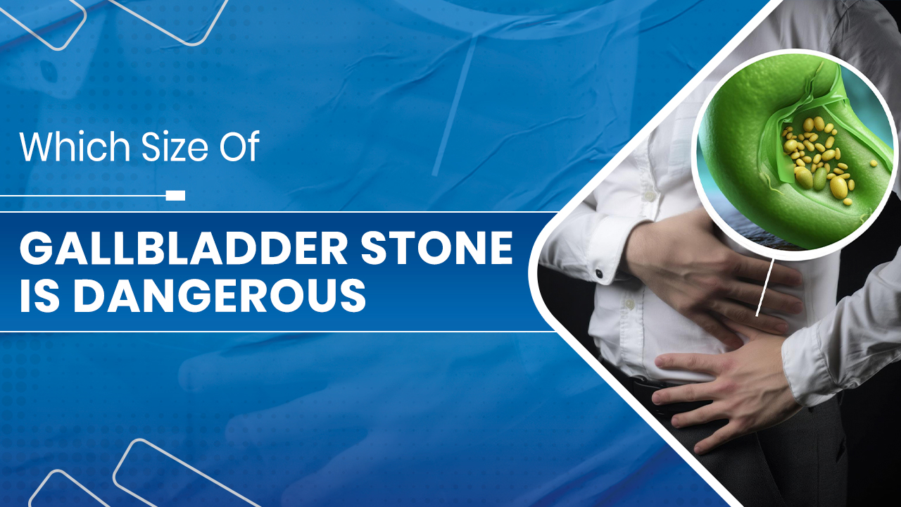 Gallbladder stone removal surgery