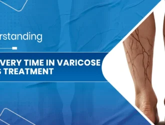 Recovery Time in Varicose Veins Treatment