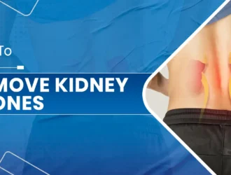 Remove Kidney Stones