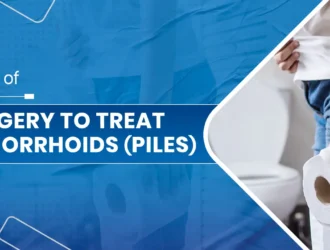 Surgery to Treat Hemorrhoids (Piles)