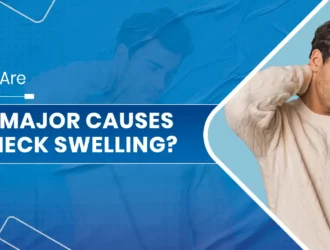 The Major Causes of Neck Swelling