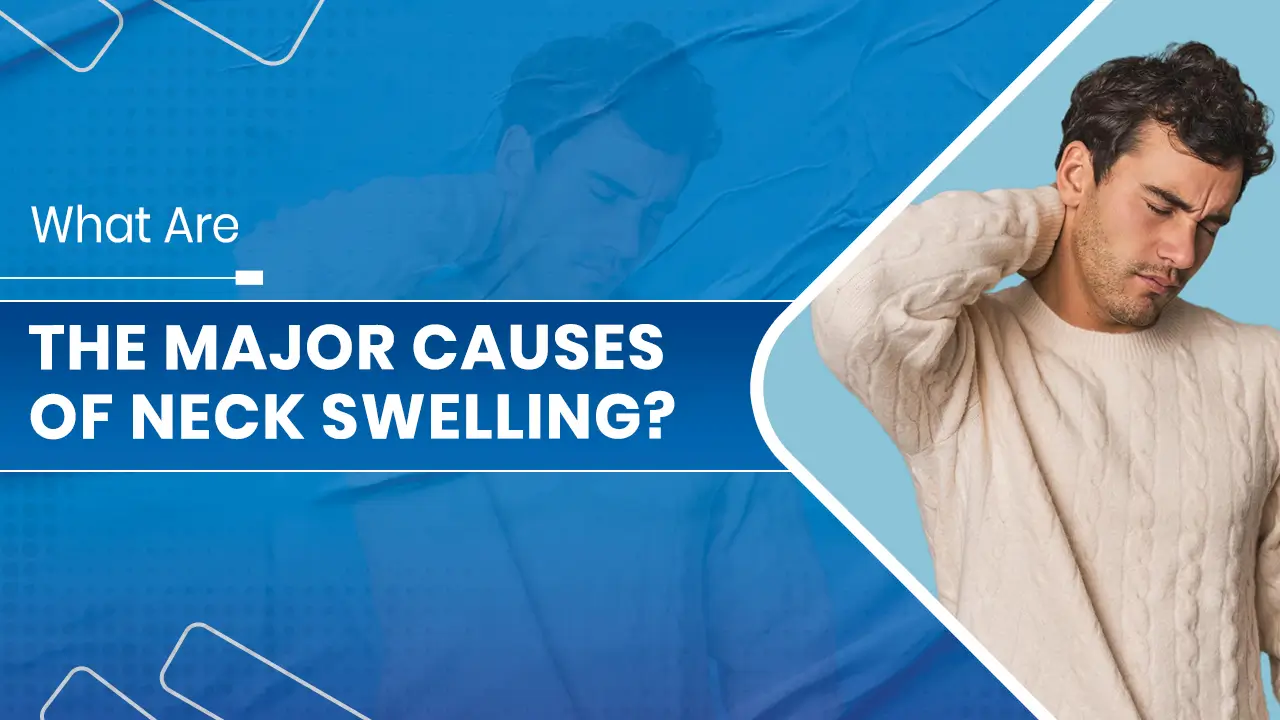 The Major Causes of Neck Swelling