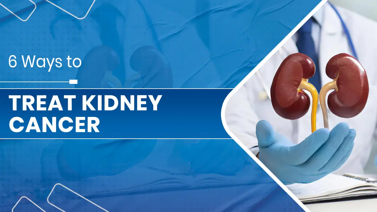 Treat Kidney Cancer