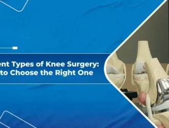 Different Types of Knee Surgery