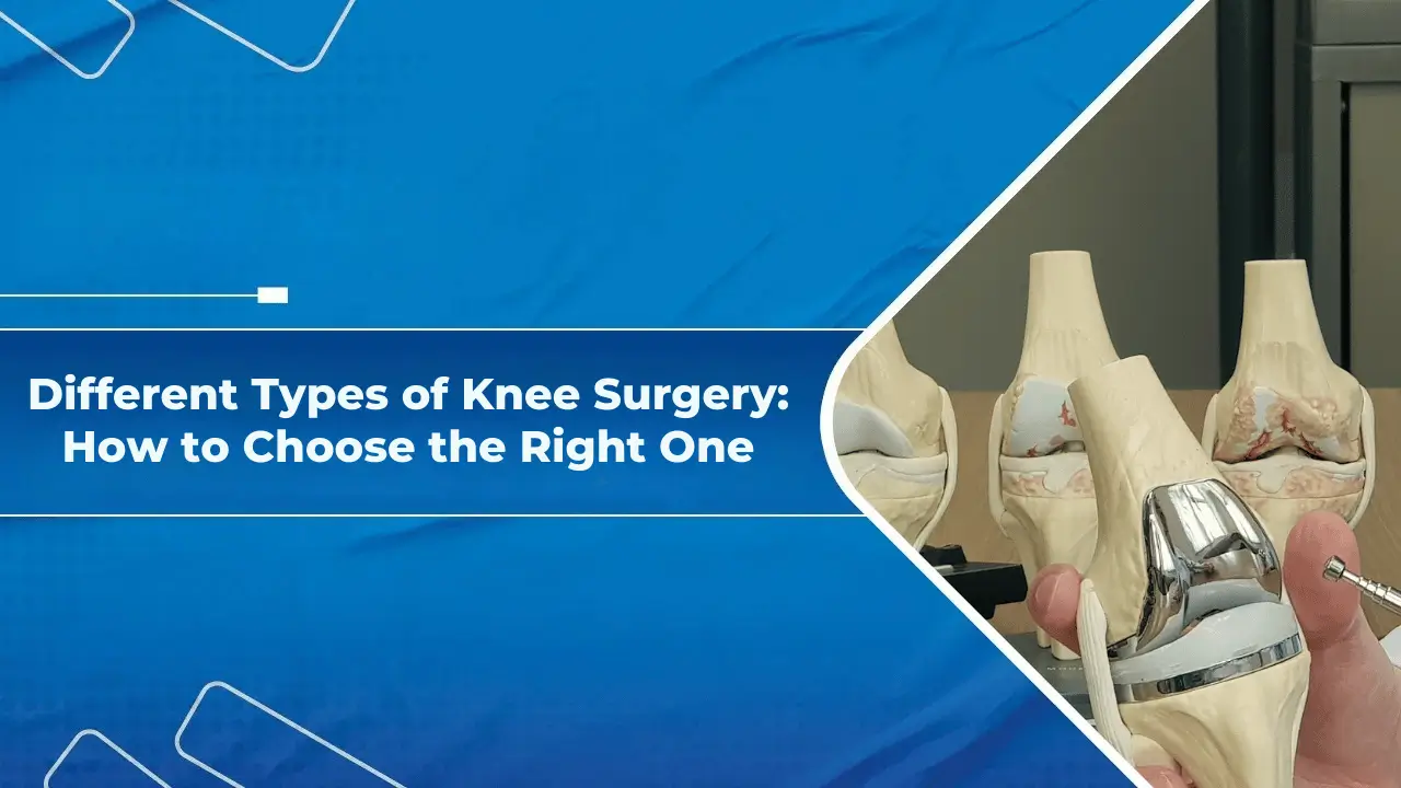 Different Types of Knee Surgery