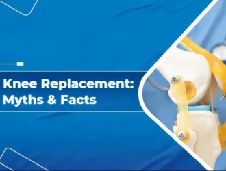 Total Knee Replacement Myths & Facts