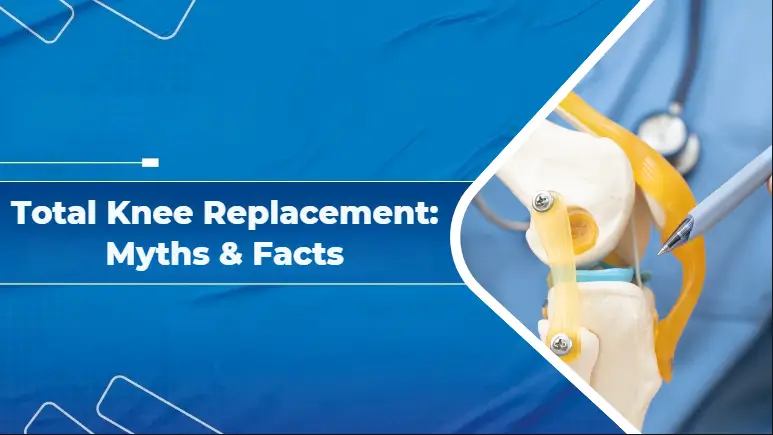Total Knee Replacement Myths & Facts
