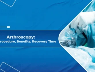 Arthroscopy - Types, Procedure, Benefits, Recovery Time