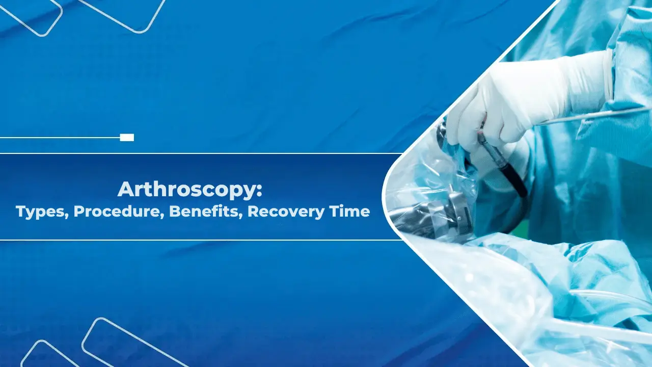 Arthroscopy - Types, Procedure, Benefits, Recovery Time