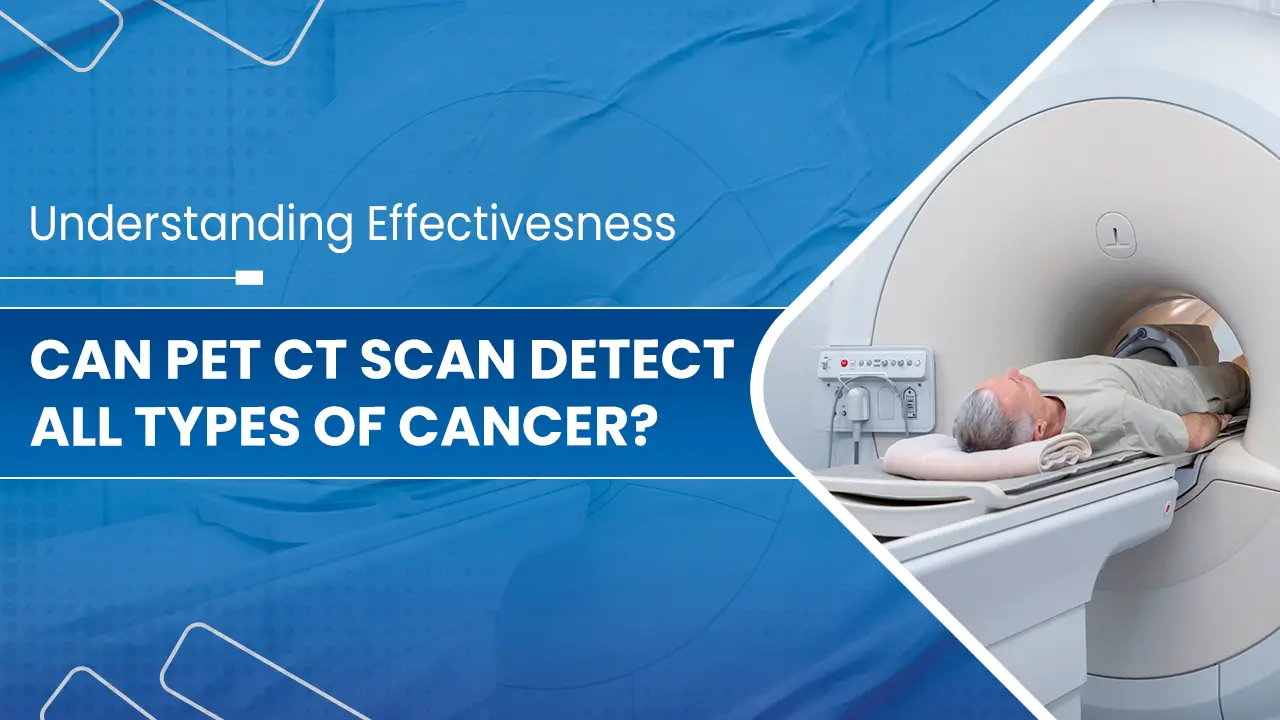 Can-PET-CT-Scan-Detect-all-types-of-Cancer