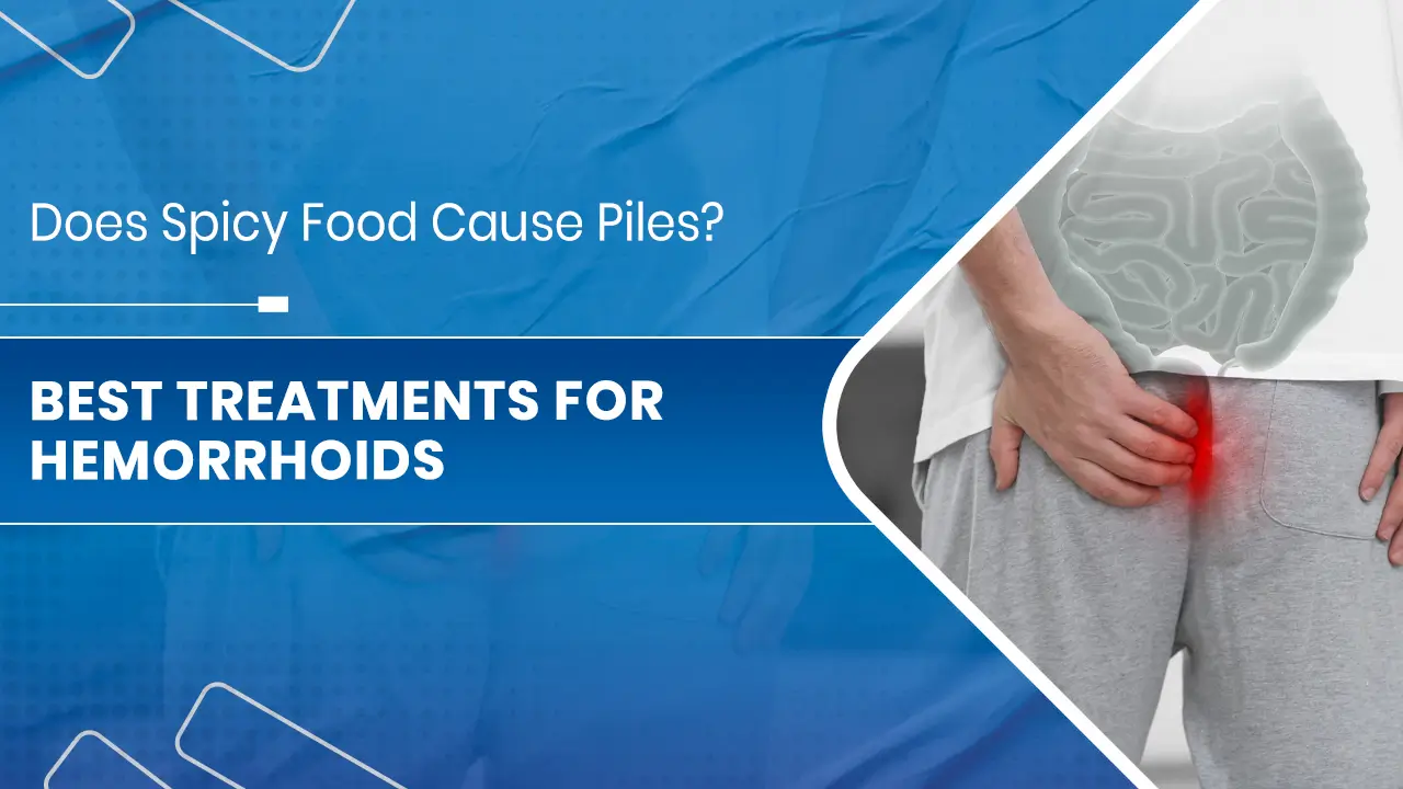 Does Spicy Food Cause Piles