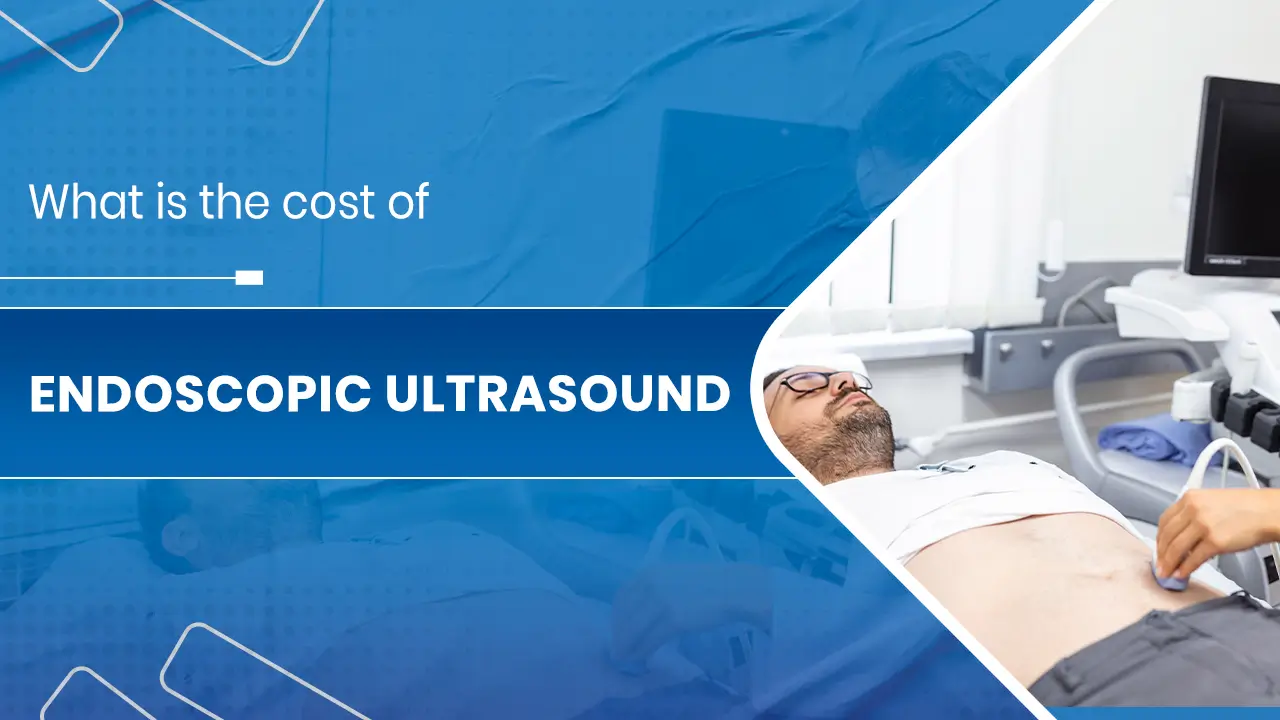 Endoscopic Ultrasound 01
