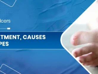 Foot Ulcers