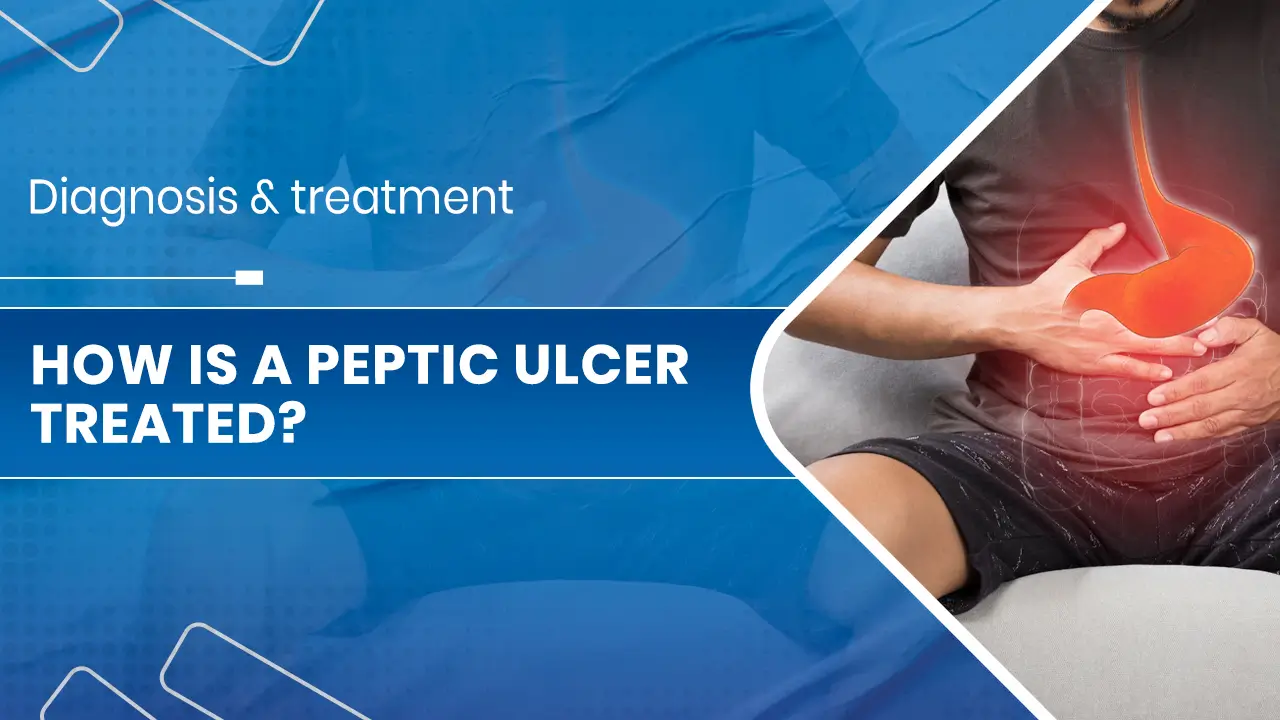 How is a Peptic Ulcer treated