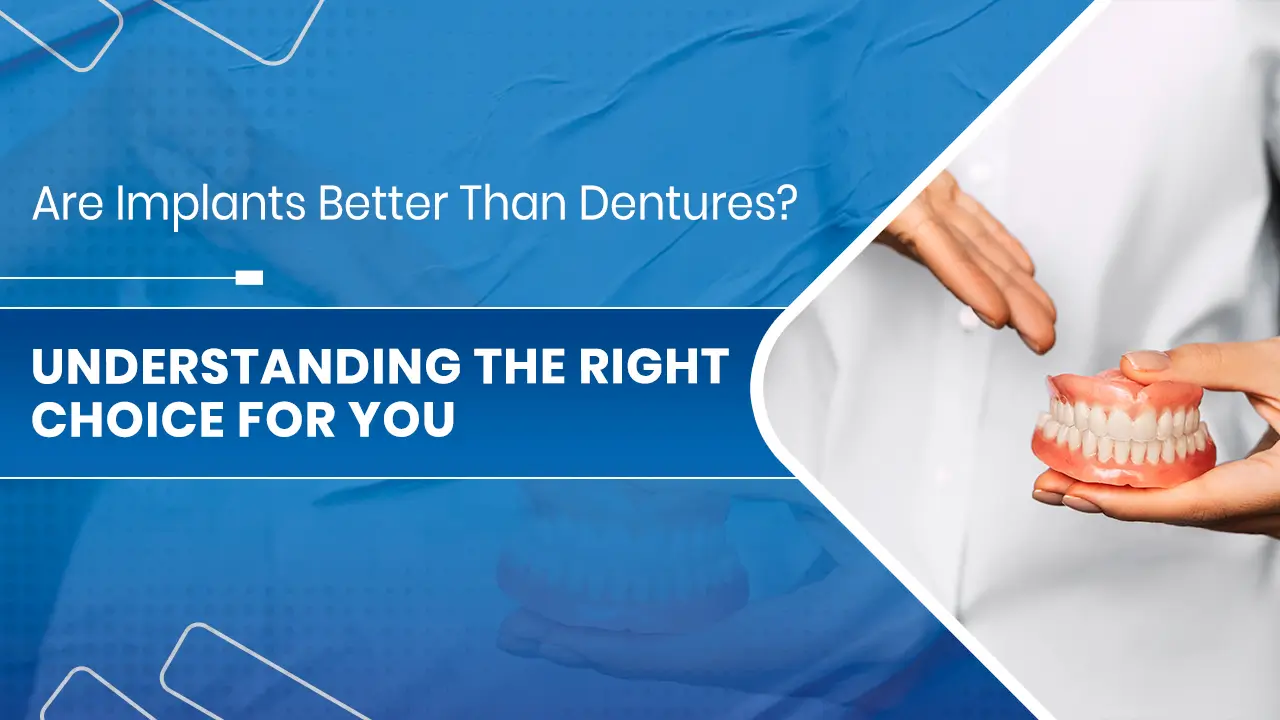 Implants Better Than Dentures