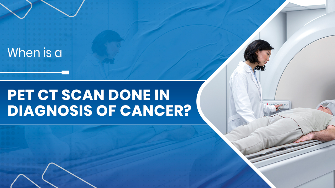 PET CT Scan