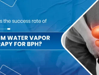 Rezum water vapor Therapy for BPH