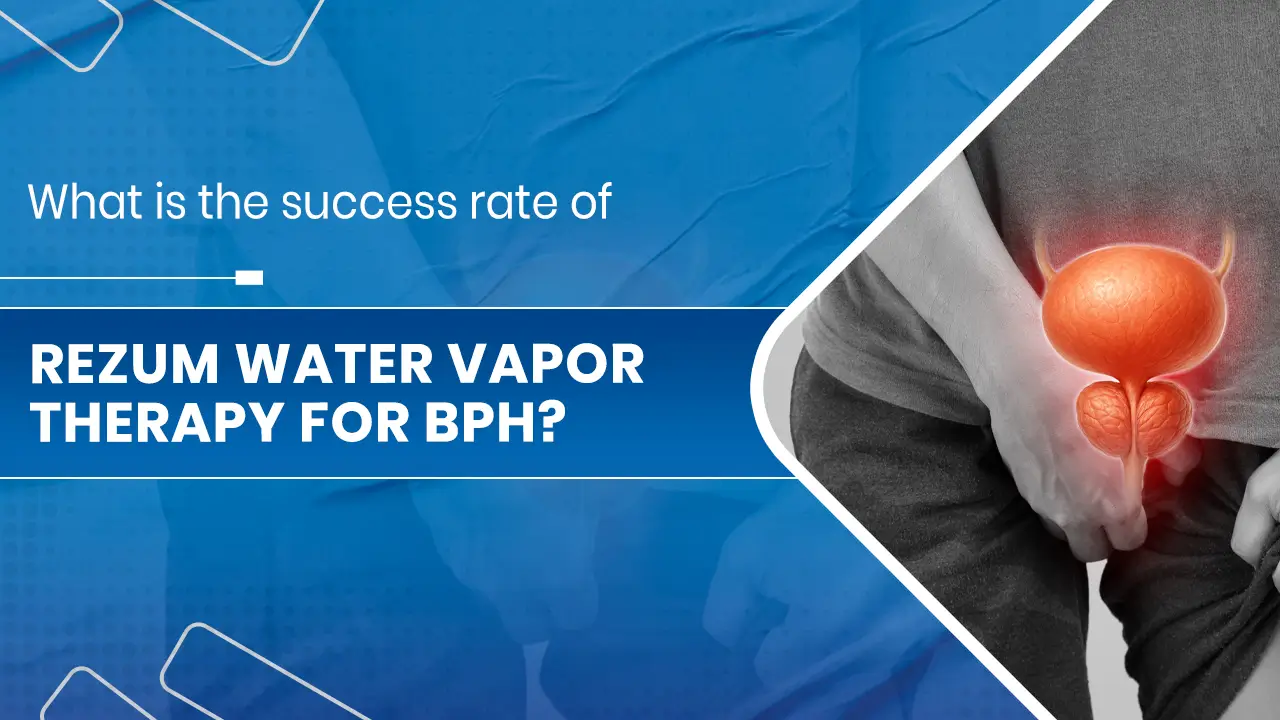 Rezum water vapor Therapy for BPH