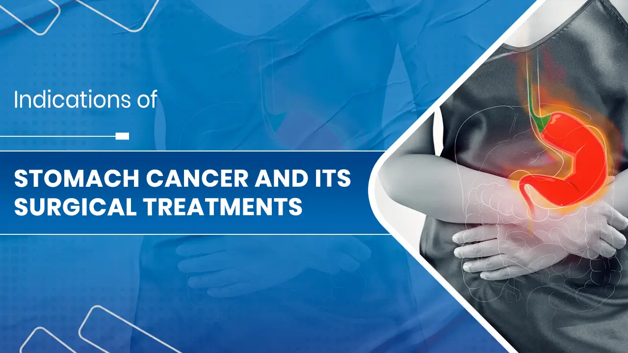 Stomach Cancer and Its Surgical Treatments