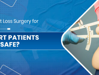 bariatric surgery