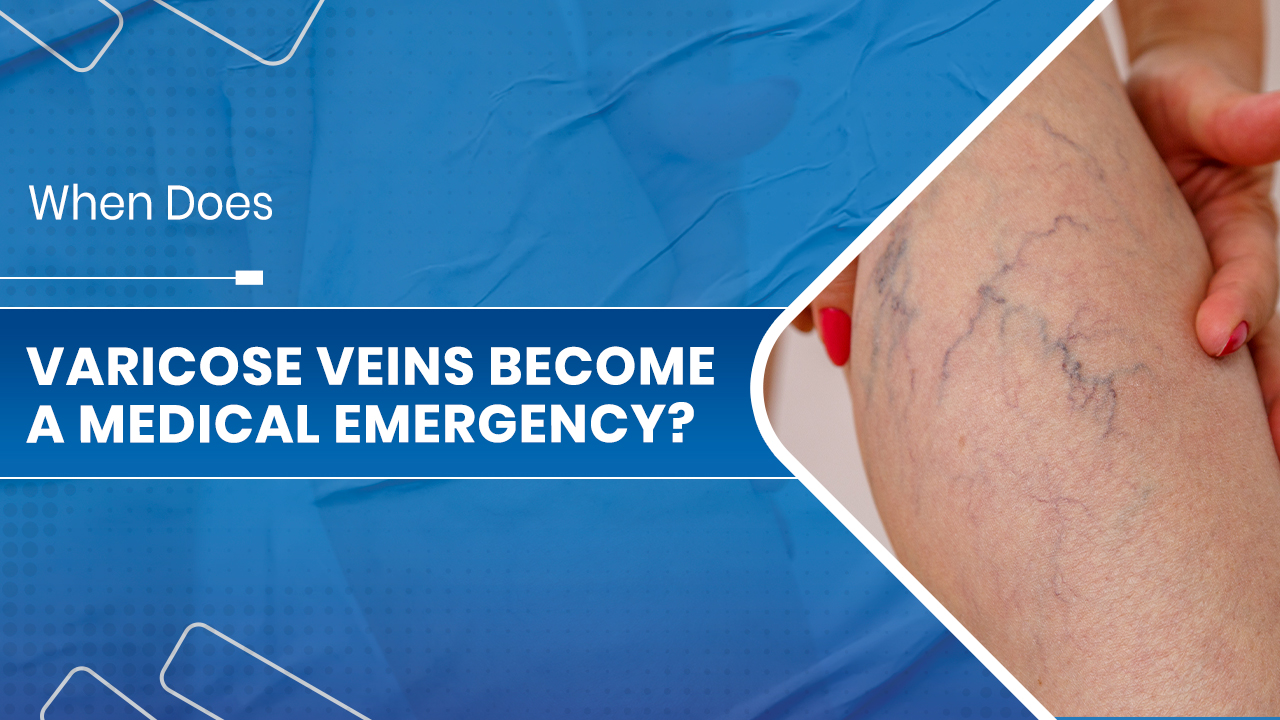 Varicose veins specialist