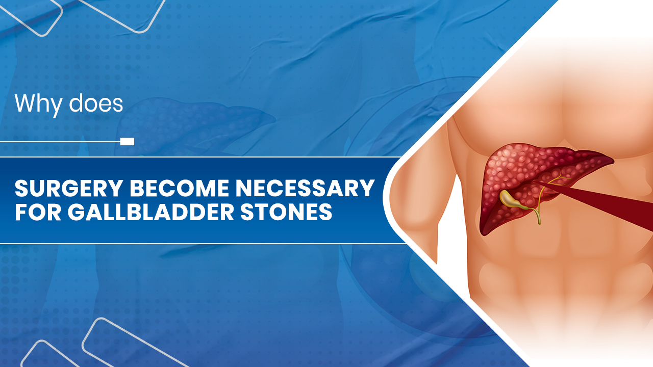 Gallbladder stones 01