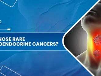 Neuroendocrine cancers