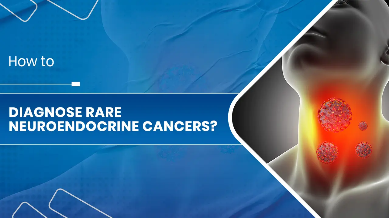 Neuroendocrine cancers