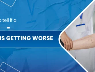 PAD is getting worse