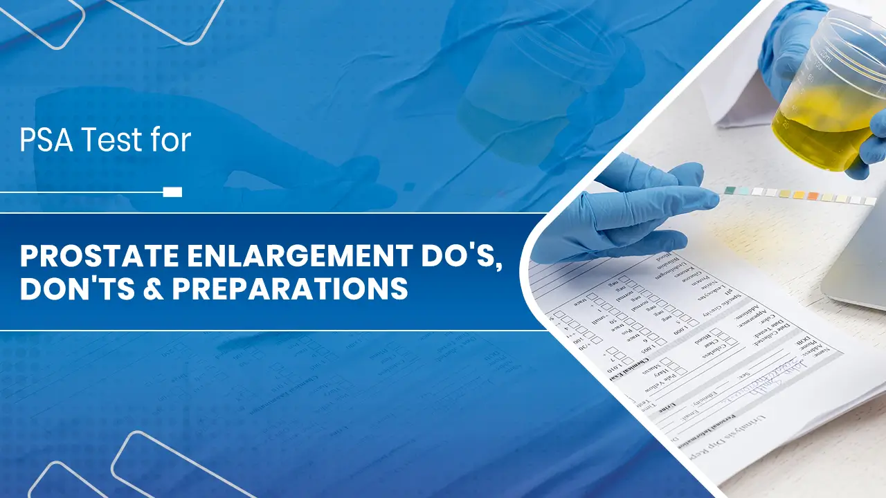 PSA Test for Prostate Enlargement